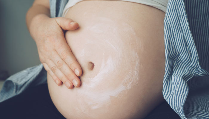 Home Made Stretch Marks Cream